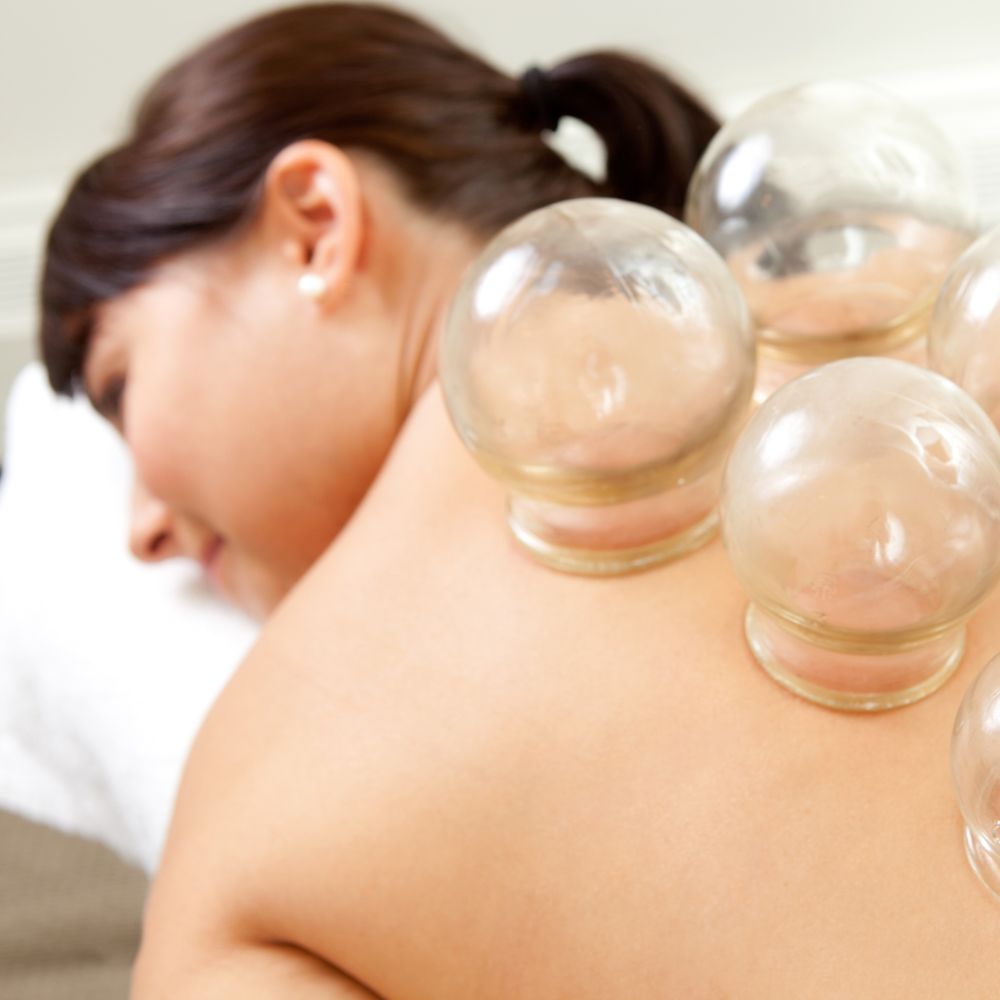 Cupping and Gua Sha link - Woman Undergoing Cupping Therapy